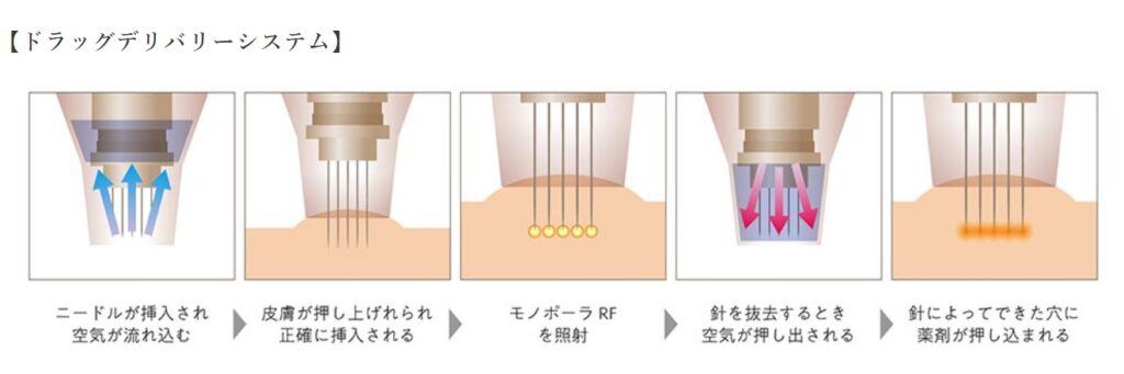 ドラッグデリバリーシステム