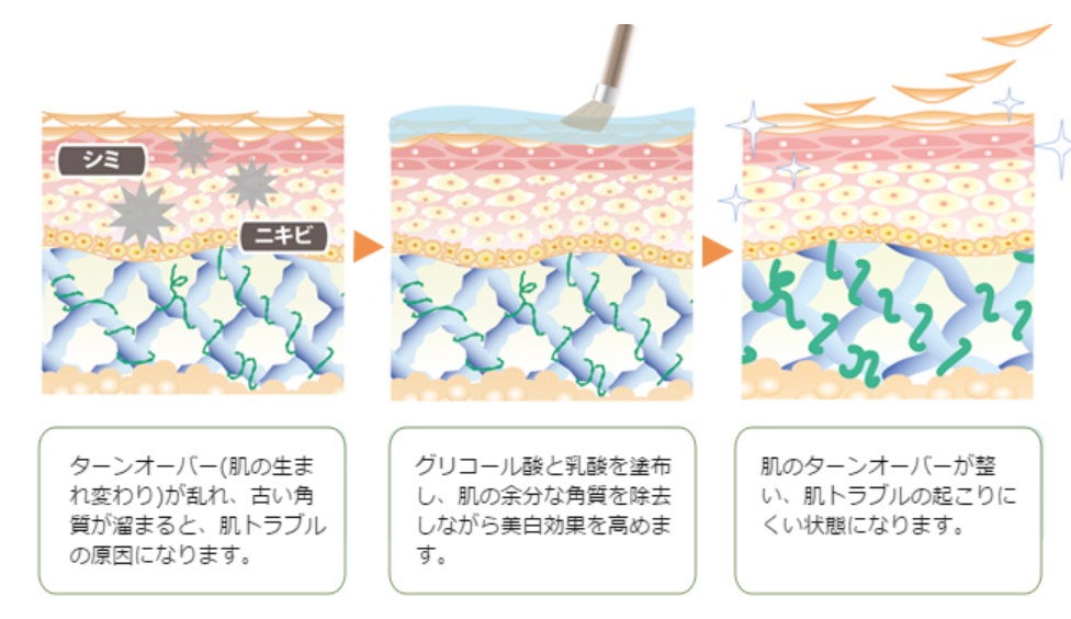 ケミカルピーリング